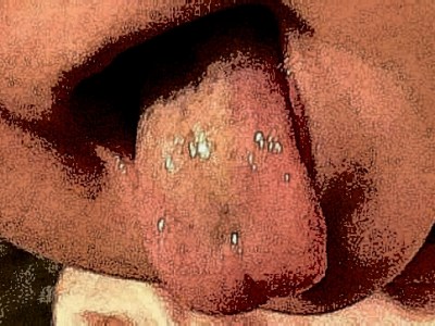 Language Issues in Our Marriage: When ESL Mistakes Get&nbsp;Frustrating